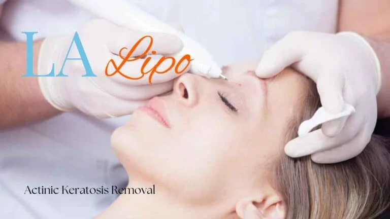 Woman receiving Actinic Keratosis Removal Treatment Merton
