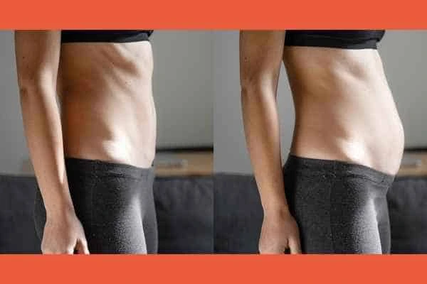 LA-EMS Body Sculpting results Merton