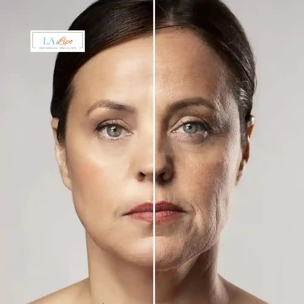 How Can You Tell If Non-Surgical Skin Tightening Is Right for You Merton?